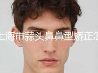 上海市蒜头鼻鼻型矫正怎么样价格表-上海市蒜头鼻鼻型矫正手术有多贵