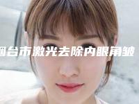 烟台市激光去除内眼角皱纹价位表项目详细一览(激光去除内眼角皱纹整形术费用是多少)