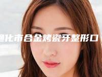 通化市合金烤瓷牙整形口腔科价格表全新版上线(8月-3月合金烤瓷牙整形均价为：15711元)