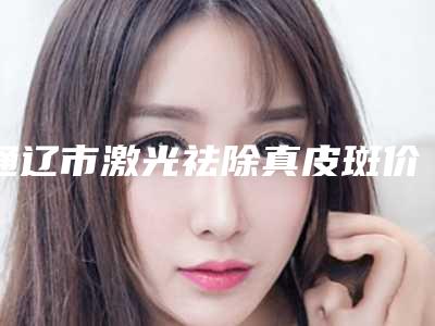 通辽市激光祛除真皮斑价格(收费标准)特色经典项目-通辽市激光祛除真皮斑价格抢先看
