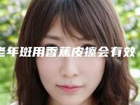 老年斑用香蕉皮擦会有效果_激光去老年斑会不会不掉痂